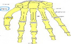 Fracture de la main pour Ann Wauters Fracture de la main pour Ann Wauters
